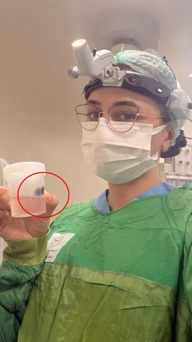 Siirt'te 10 yaşındaki çocuğun boğazından canlı sülük çıktı