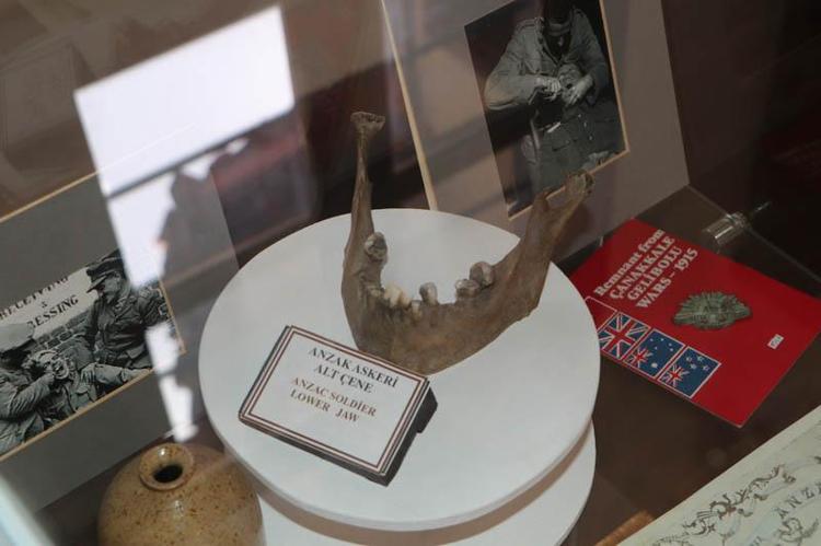 Atatürk'ün damak kalıbının örneği, Enver Paşa'nın azı dişi aynı müzede
