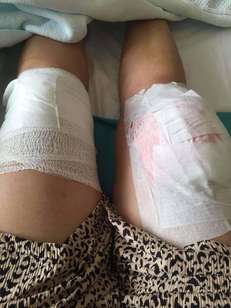 Aysel'i sokak ortasında vuran eski eşe verilen cezayı Yargıtay bozdu